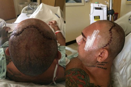 Фото: "Киборг" Сантос до и после операции